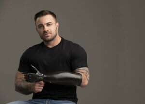 Athletic white man, brown hair, wearing a black shirt, has arms folded. He is an amputee whose left forearm and hand are prosthetic.